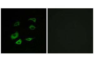 Immunofluorescence analysis of HepG2 cells, using Cyclosome 1 antibody. (APC1 Antikörper  (Internal Region))