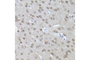 Immunohistochemistry of paraffin-embedded mouse brain using RNF166 antibody. (RNF166 Antikörper)