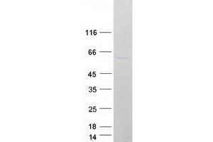 Western Blotting (WB) image for Pellino E3 Ubiquitin Protein Ligase 1 (PELI1) protein (Myc-DYKDDDDK Tag) (ABIN2728649)