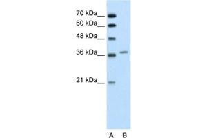 Western Blotting (WB) image for anti-Aminolevulinate Dehydratase (ALAD) antibody (ABIN2462446) (ALAD Antikörper)