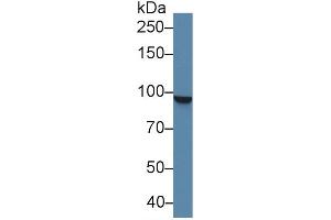 Western blot analysis of Human K562 cell lysate, using Human STAT5A Antibody (2 µg/ml) and HRP-conjugated Goat Anti-Rabbit antibody ( (STAT5A Antikörper  (AA 673-773))