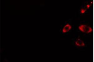 ABIN6274440 staining HuvEc cells by IF/ICC. (RIN3 Antikörper  (Internal Region))
