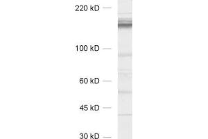 Western Blotting (WB) image for anti-CAP-GLY Domain Containing Linker Protein 1 (CLIP1) (AA 1283-1438) antibody (ABIN1742487) (CLIP1 Antikörper  (AA 1283-1438))