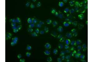 Image no. 2 for anti-Nucleotide Exchange Factor SIL1 (SIL1) antibody (ABIN1496810) (SIL1 Antikörper)