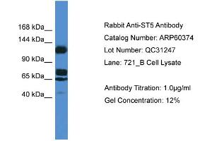 Western Blotting (WB) image for anti-Suppression of Tumorigenicity 5 (ST5) (Middle Region) antibody (ABIN2788427) (ST5 Antikörper  (Middle Region))