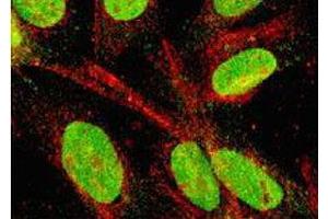 Immunofluorescence (IF) image for anti-Mechanistic Target of Rapamycin (serine/threonine Kinase) (mTOR) (Exon 5), (Exon 6) antibody (ABIN2487252)