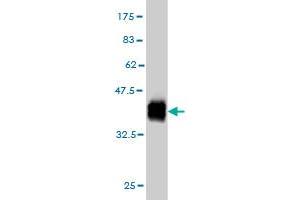 Western Blot detection against Immunogen (37. (ZNF41 Antikörper  (AA 221-321))