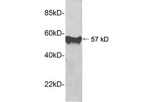 Western blot analysis of recombinant human PIN1 protein using 1 µg/mL Rabbit Anti-PIN1 Polyclonal Antibody (ABIN398689) The signal was developed with IRDyeTM 800 Conjugated Goat Anti-Rabbit IgG (PIN1 Antikörper  (AA 50-100))