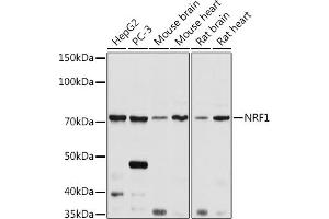 Western blot analysis of extracts of various cell lines, using NRF1 antibody (ABIN6128358, ABIN6144851, ABIN6144853 and ABIN6221193) at 1:1000 dilution. (NRF1 Antikörper  (AA 240-449))