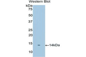 Western blot analysis of the recombinant protein. (PSCA Antikörper  (AA 22-123))