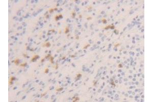 Detection of CASP1 in Human Spleen Tissue using Polyclonal Antibody to Caspase 1 (CASP1) (Caspase 1 Antikörper  (AA 120-297))