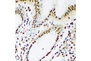 Immunohistochemistry (IHC) image for anti-TAR DNA Binding Protein (TARDBP) antibody (ABIN7308400) (TARDBP Antikörper)
