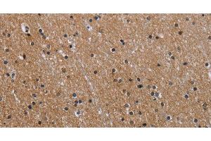 Immunohistochemistry of paraffin-embedded Human brain using GAB2 Polyclonal Antibody at dilution of 1:40 (GAB2 Antikörper)
