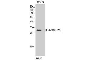 Western Blotting (WB) image for anti-CD40 (CD40) (pThr254) antibody (ABIN3182275) (CD40 Antikörper  (pThr254))