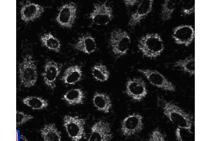 Immunofluorescent staining of A549 (ATCC CCL-185) cells. (HSPD1 Antikörper)