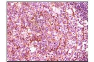 Immunohistochemistry (IHC) image for anti-zeta-Chain (TCR) Associated Protein Kinase 70kDa (ZAP70) (truncated) antibody (ABIN2464121)