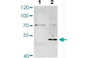 Western blot analysis of Lane 1: Untreated Jurkat cells, Lane 2: Starvation treated Jurkat cells with MAX (phospho S11) polyclonal antibody  at 1:500-1:2000 dilution. (MAX Antikörper  (pSer11))