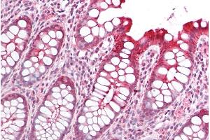 ABIN185725 (5µg/ml) staining of paraffin embedded Human Colon. (PICK1 Antikörper  (Internal Region))