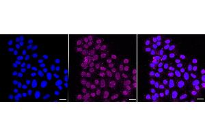 Immunocytochemical staining of HepG2 cells with Erb-b2 receptor tyrosine kinase 2 antibody (ABIN7800156), 1:1,000).