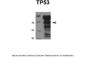DU145 cells were lysed in IP lysis buffer (20mM HEPES, 1% Triton X-100, 150mM NaCl, 1mMEDTA, 1mM EGTA, 100mM NaF, 10mM Na4P2O7, 1mM Na3VO4, 0. (p53 Antikörper  (N-Term))
