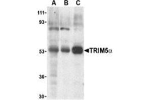 Western blot analysis of TRIM5 alpha expression in human stomach (A), thymus (B), and uterus (C) cell lysate with this product at 2 μg /ml. (TRIM5 Antikörper  (Isoform alpha, Middle Region))