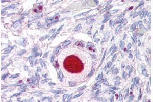 Anti-NR5A1 antibody  ABIN1049145 IHC staining of human ovary. (NR5A1 Antikörper  (Internal Region))