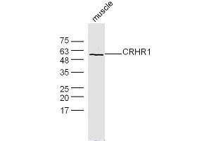 Mouse muscle lysates probed with CRHR1 Polyclonal Antibody, Unconjugated  at 1:300 dilution and 4˚C overnight incubation. (CRHR1 Antikörper  (AA 55-150))