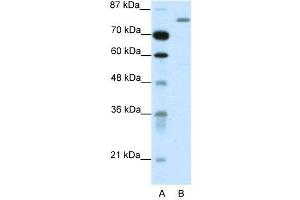 WB Suggested Anti-TRIM28  Antibody Titration: 1. (KAP1 Antikörper  (C-Term))