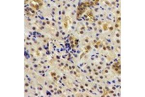 Immunohistochemical analysis of Deltex-2 staining in human kidney formalin fixed paraffin embedded tissue section. (DTX2 Antikörper)