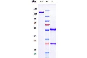 Anti-IL-12b Reference Antibody (ebdarokimab) on SDS-PAGE under reducing (R) condition. (Rekombinanter IL12B (Ebdarokimab Biosimilar) Antikörper)