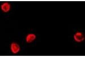 Immunofluorescent analysis of TCF4 staining in Hela cells. (TCF4 Antikörper)