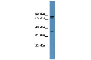 WB Suggested Anti-PDE8A Antibody Titration: 0. (PDE8A Antikörper  (C-Term))