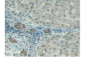Immunohistochemistry (IHC) image for anti-Serpin Peptidase Inhibitor, Clade G (C1 Inhibitor), Member 1 (SERPING1) (AA 399-500) antibody (ABIN7431428)