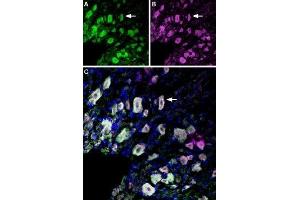 Immunolocalization of p75NTR and TrkA in rat dorsal root ganglion - Immunohistochemical staining of perfusion-fixed frozen rat dorsal root ganglia (DRG) sections using Anti-p75 NGF Receptor (extracellular)-ATTO Fluor-488 Antibody (ABIN7043345), (1:60) and Anti-TrkA (extracellular)-ATTO Fluor-633 Antibody (ABIN7043386), (1:60).