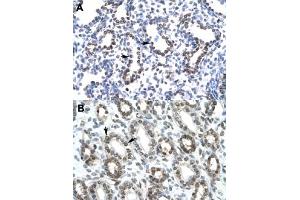 Immunohistochemical staining (Formalin-fixed paraffin-embedded sections) of human lung (A) and human kidney (B) with HEY1 polyclonal antibody  at 4-8 ug/mL working concentration.