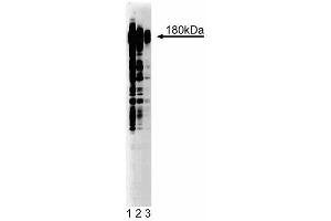 Western blot analysis of Phosphotyrosine on A431 lysate. (Phosphotyrosine Antikörper)