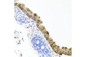 Immunohistochemistry of paraffin-embedded mouse lung using TOPBP1 antibody (ABIN6134114, ABIN6149397, ABIN6149400 and ABIN6216254) at dilution of 1:100 (40x lens). (TOPBP1 Antikörper  (AA 1-100))