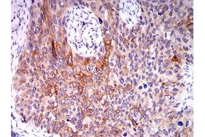 Immunohistochemistry (IHC) image for anti-CPV-VP2 (AA 1-128) antibody (ABIN5869165) (CPV-VP2 (AA 1-128) Antikörper)