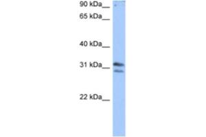 Western Blotting (WB) image for anti-RNA (Guanine-9-) Methyltransferase Domain Containing 3 (RG9MTD3) antibody (ABIN2462336)