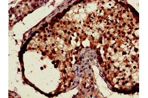 Immunohistochemistry (IHC) image for anti-Casein Kinase 1, alpha 1 (CSNK1A1) (AA 2-337), (Isoform alpha) antibody (ABIN7146852)