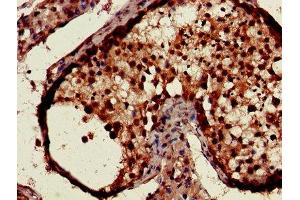 Immunohistochemistry of paraffin-embedded human testis tissue using ABIN7146852 at dilution of 1:100 (CSNK1A1 Antikörper  (Isoform alpha))