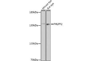 Western blot analysis of extracts of various cell lines, using PHLPP2 antibody (ABIN7269259) at 1:1000 dilution. (PHLPP2 Antikörper)