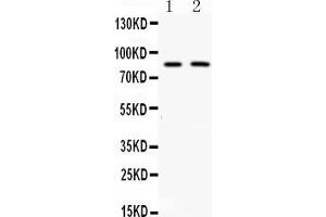 Western blot analysis of MUT expression in rat kidney extract ( Lane 1) and 22RV1 whole cell lysates ( Lane 2). (MUT Antikörper  (N-Term))