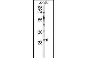 Western blot analysis of anti-WBP2 Antibody in A2058 cell line lysates (35ug/lane)