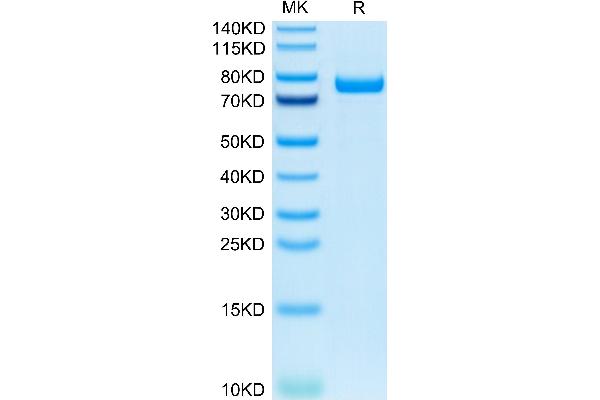IL5RA Protein (AA 21-335) (Fc Tag)