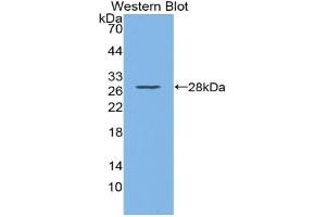 Western blot analysis of recombinant Mouse CD72. (CD72 Antikörper  (AA 143-345))