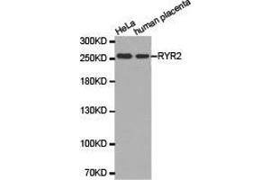 Western Blotting (WB) image for anti-Ryanodine Receptor 2 (Cardiac) (RYR2) antibody (ABIN1874679) (RYR2 Antikörper)