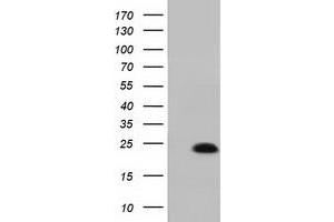 Western Blotting (WB) image for anti-MOB Kinase Activator 1B (MOB1B) antibody (ABIN1499533) (MOBKL1A Antikörper)