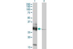 Western Blot analysis of VAPB expression in transfected 293T cell line by VAPB MaxPab polyclonal antibody. (VAPB Antikörper  (AA 1-243))