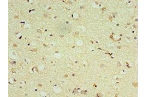Immunohistochemistry of paraffin-embedded human brain tissue using ABIN7149474 at dilution of 1:100 (DRD3 Antikörper  (AA 213-329))